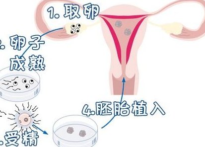 三亚第三代试管生孩子费用多少？